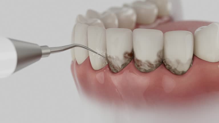 Reliable Dental Implants contractor in Ashland, WI by Smile Center Dentistry